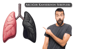 Akciğer Kanserinin Sebepleri